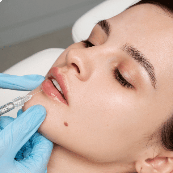 Lip filler 5