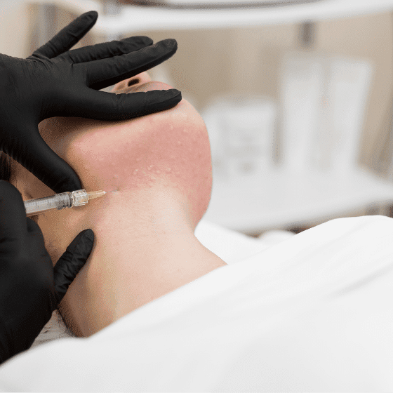 How to Care for Skin After Botox? 60 Botox