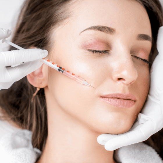 Can Fillers Fix Smile Lines and Under Eye Hollows? (A Complete Restoration Guide) 39 Line Filler
