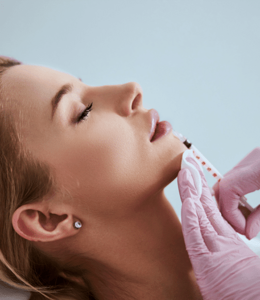 Do Fillers Stretch Your Lips? 27 Lip Filler