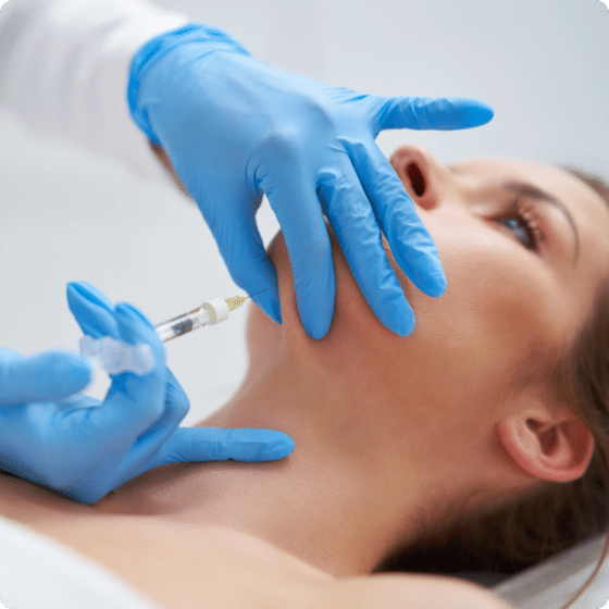 chin filler 1