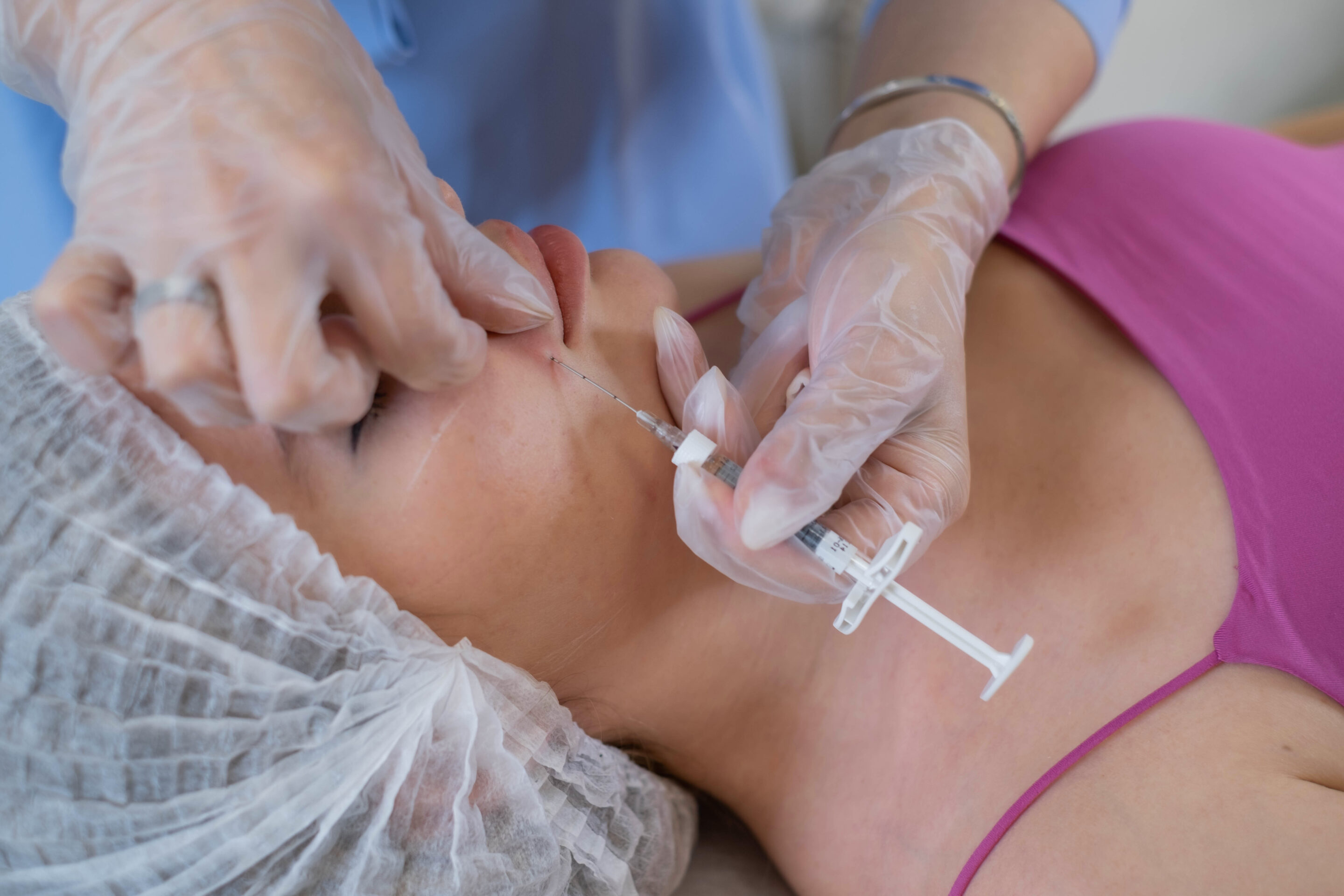 Botox and filler