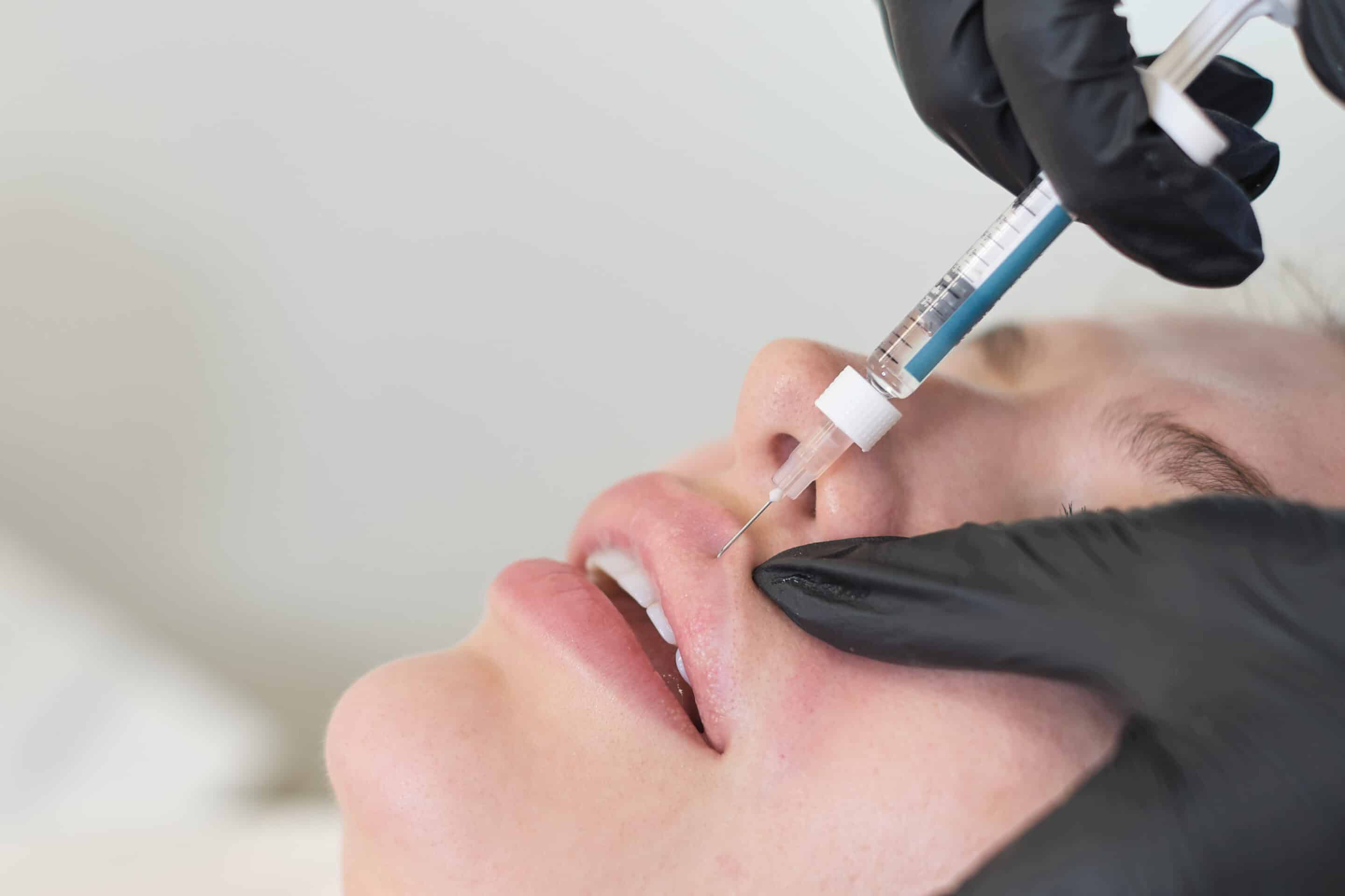Are There Side Effects After Botox or Filler Injections? 42 Derma Filler