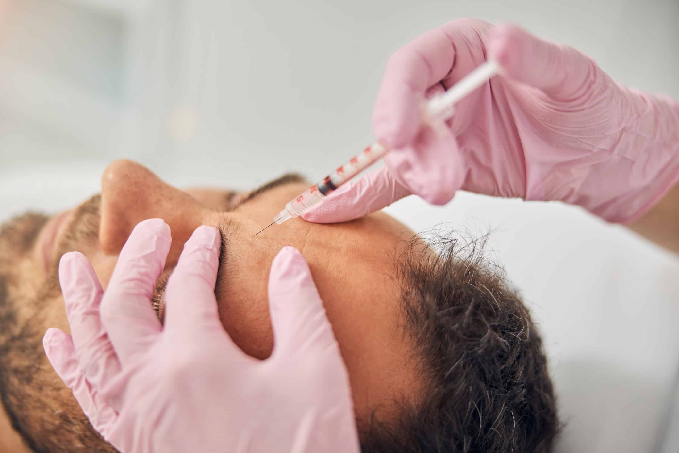 Can Men Get Botox and Fillers? The Modern Guide to Male Aesthetics 37 Forehead Injection