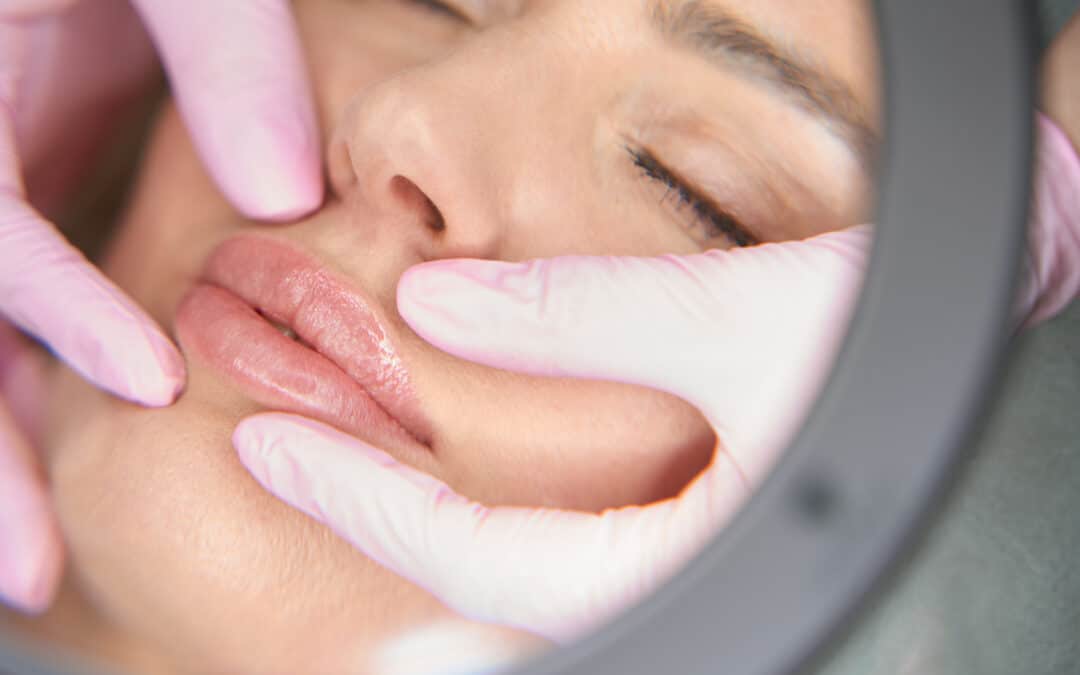 Understanding Your Options: What Is a Lip Filler?