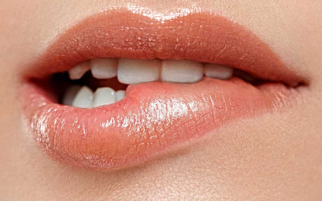 What Not to Do After Lip Filler?