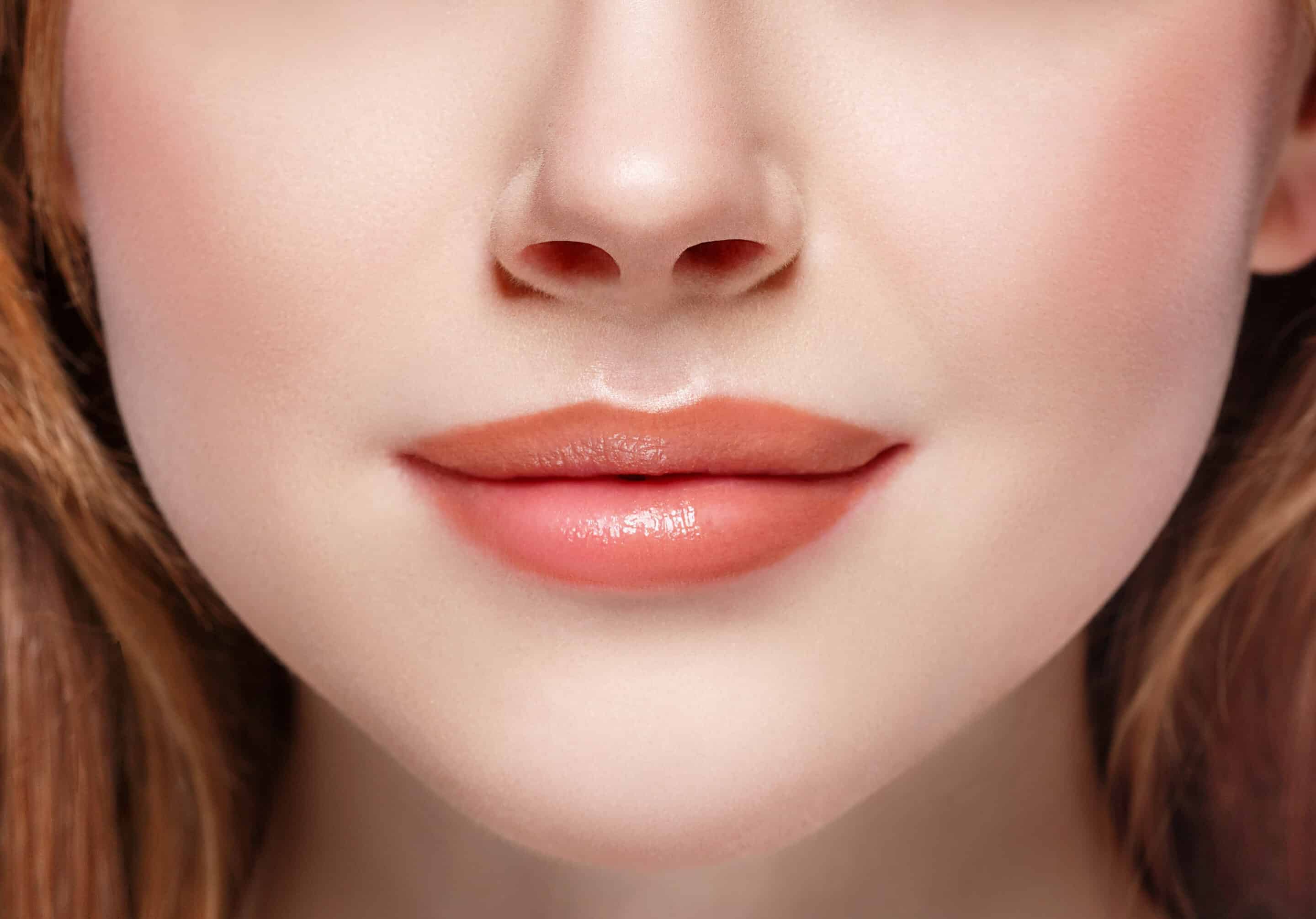 Can I Get Lip Fillers If I Have a History of Cold Sores? 2 Lip filler